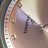 Poor "stone" setting quality, almost looks like a cheap Walmart job on the jewel setting